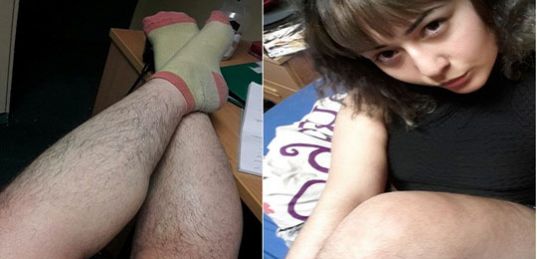 Jovem diz que se sente bem e mais livre assim (Foto: Reprodução/ Mirror)