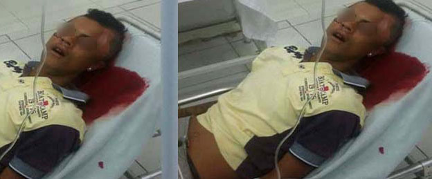 Menor de 15 anos é assassinado a tiros em São José da Laje