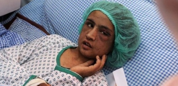 Sahar Gul, 15, foi resgatada; a família de seu marido bateu nela e a prendeu durante 5 meses em um banheiro por ela se negar a se prostituir