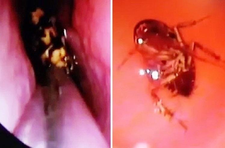 barata-viva-crânio-retirada