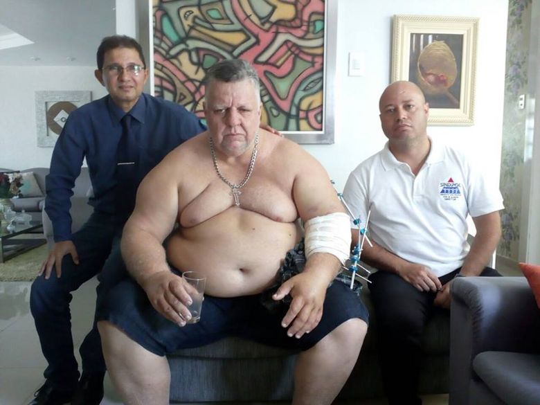 Sindpol afirma que policial ferido em atentado não era segurança de ‘Boiadeiro’