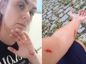 VÍDEO: Ex-paquita é filmada se cortando antes de acusar ex-marido de agressão