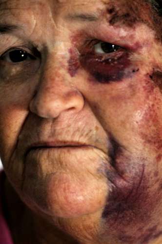 Motorista de Mercedes que arrastou idosa por 100m diz que foi brincadeira