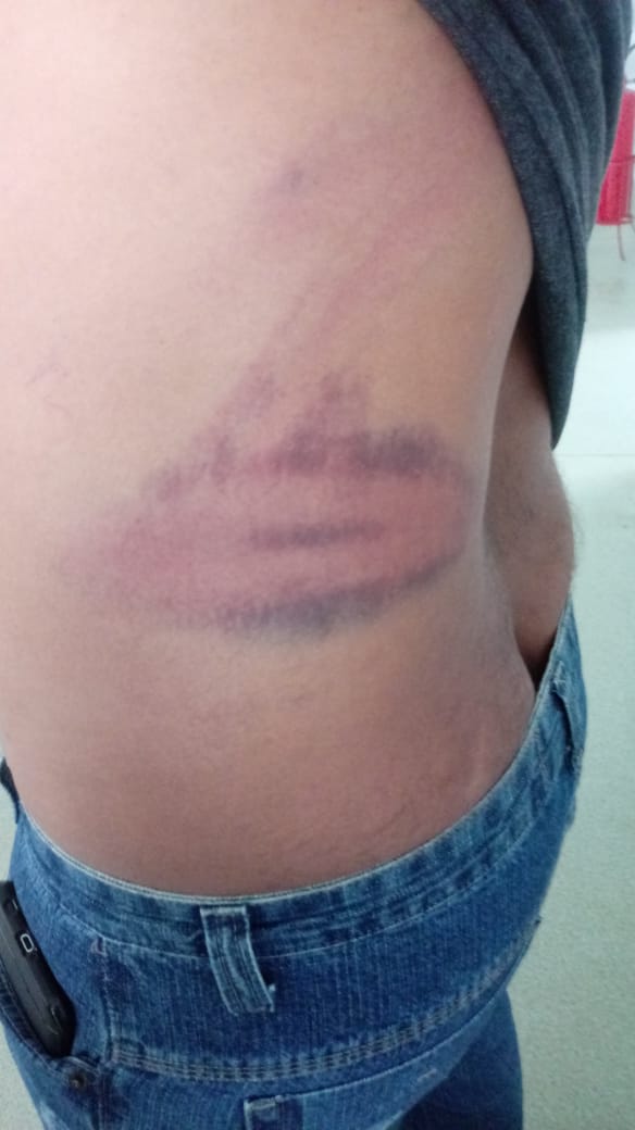 Prefeitura de Palmeira divulga nota sobre guarda municipal suspeito de agredir duas pessoas em show de Edson Lima