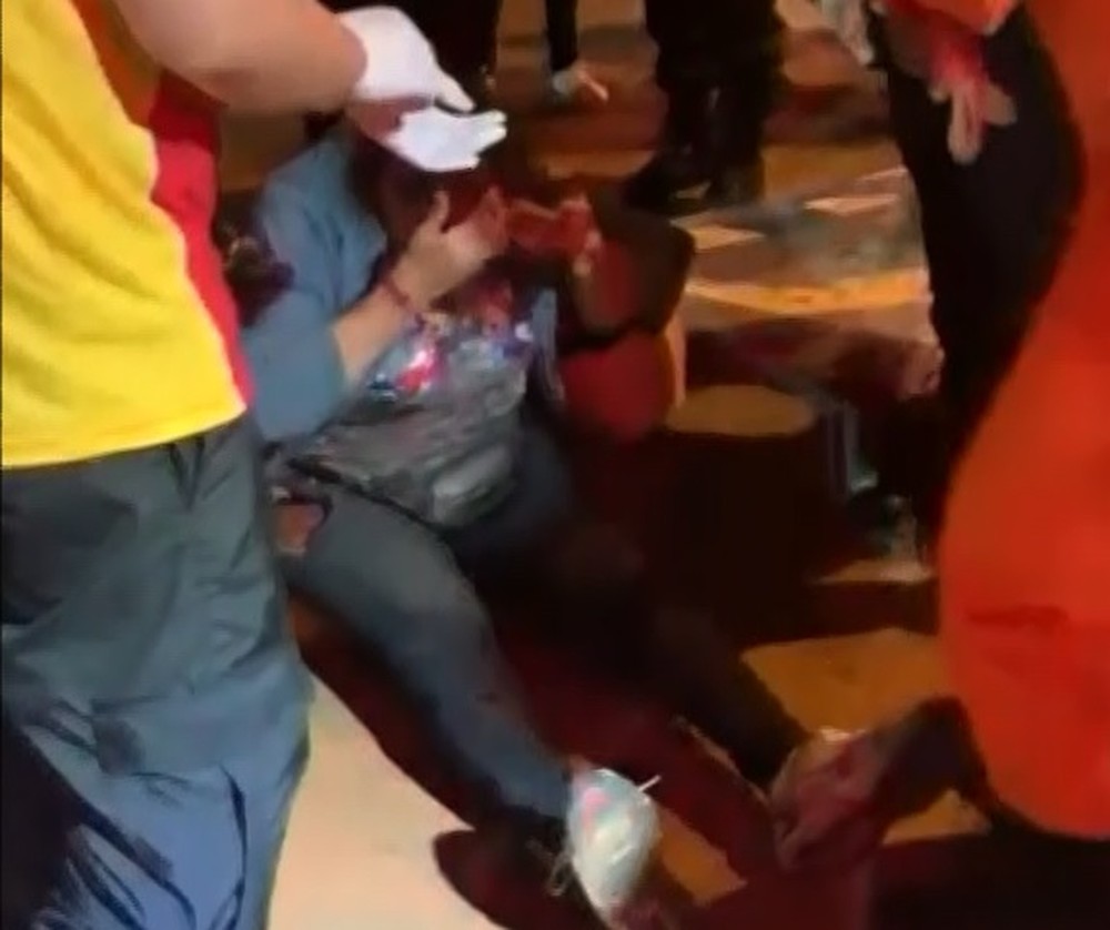 ‘Minha cabeça ficou entre as rodas’, diz vendedora de balões arrastada por Mercedes-Benz no DF