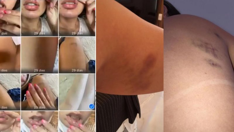 DJ Ivis estrangula e espanca mulher e não é preso após ser levado à polícia, diz Leo Dias