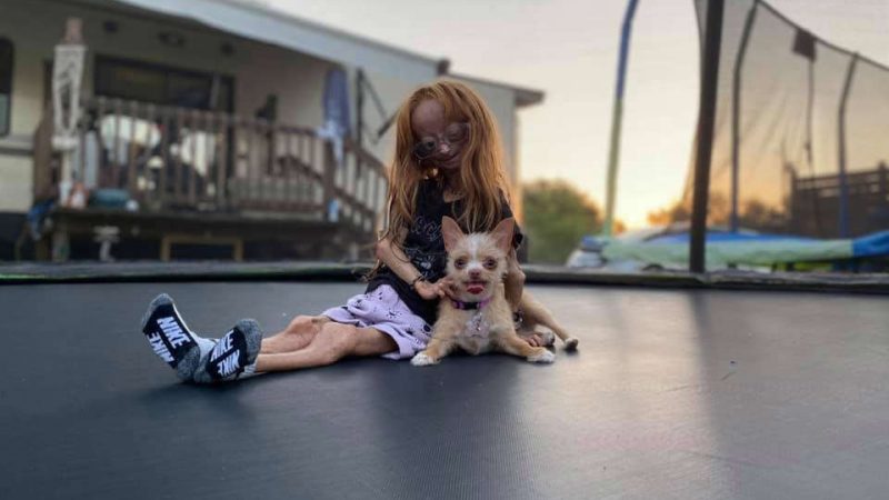 Morre youtuber com ‘síndrome de Benjamin Button’ que tinha milhões de seguidores