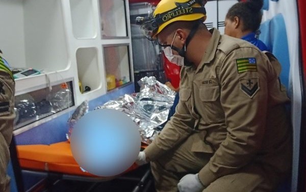 Sem dinheiro, irmãos usam álcool em fogão a lenha e sofrem queimaduras