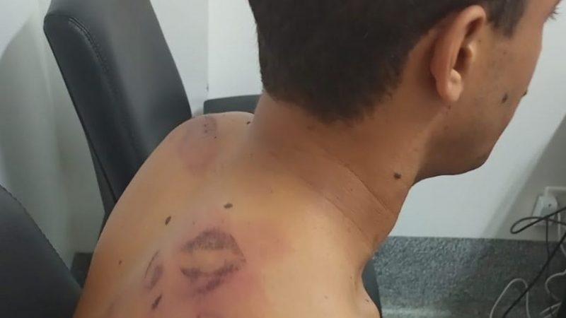 Após ter casa invadida, casal denuncia à OAB ter sido vítima de violência policial