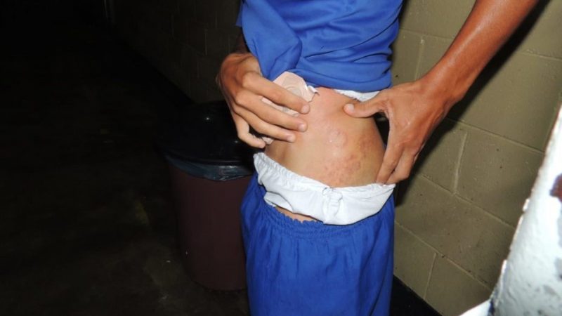 Familiares de reeducandos denunciam dois casos de tortura no Sistema Prisional de Alagoas