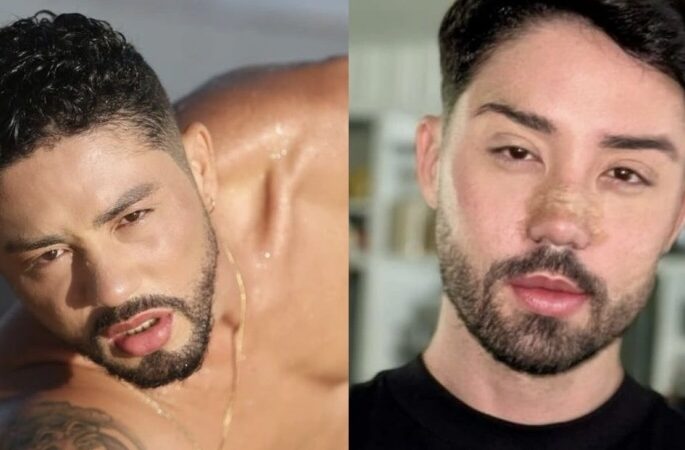 Boca, nariz, olhos: Rico Melchiades mostra resultado de cirurgias plásticas