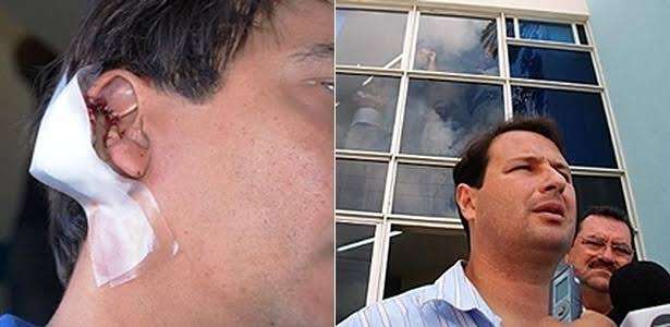 Dudu Holanda deve indenizar Paulo Corintho por mordida na orelha