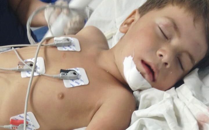 Prefeitura e Estado prestam assistência à criança atropelada por motocicleta em Palmeira