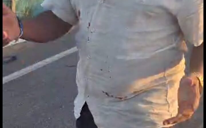 Colisão entre carro e motocicleta deixa dois mortos e dois feridos em Feira Grande