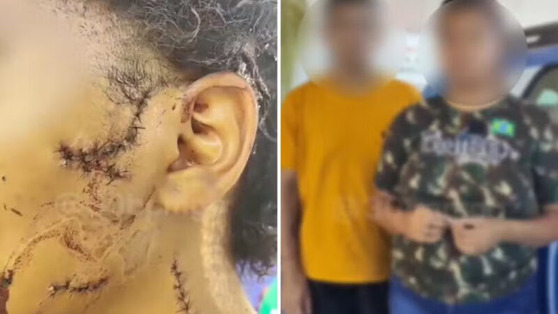 Casal é preso após confessar ter mutilado rosto de adolescente de 14 anos com garrafa, diz polícia