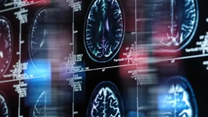 Molécula descoberta por brasileiros tem potencial contra Alzheimer