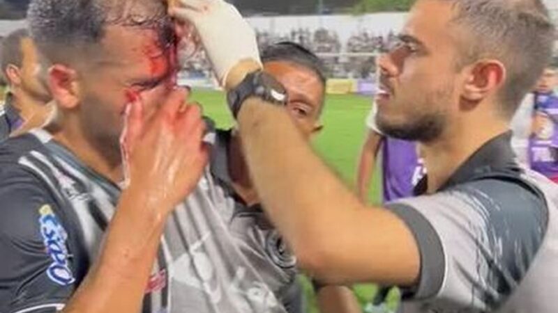 CSE ganha ação do caso Allef jogador do ASA