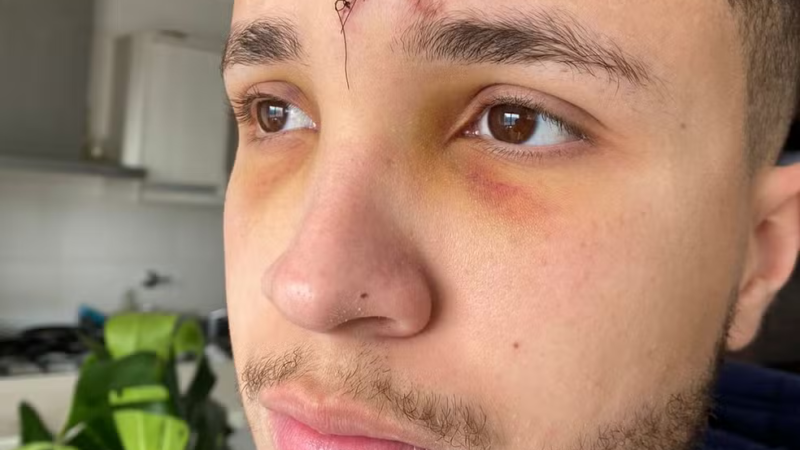 Estudantes brasileiros são agredidos e acusam homem de xenofobia na Argentina