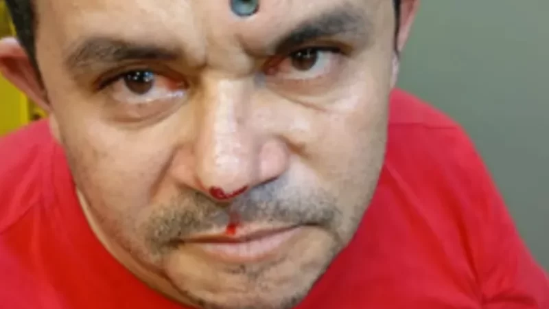 Homem leva tiro na testa e sobrevive