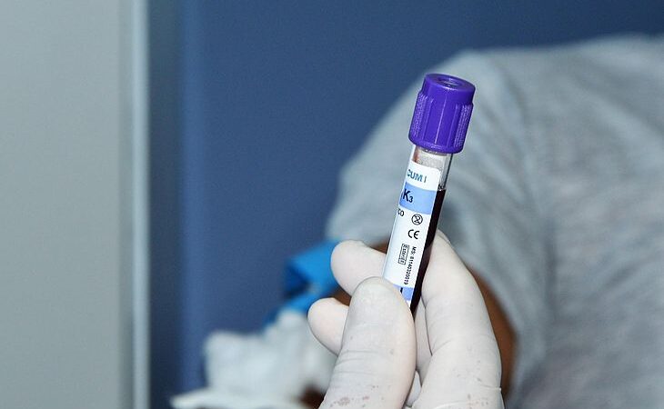 Hemoal registrar aumento de 120% no número de alagoanos cadastrados para doação de medula óssea