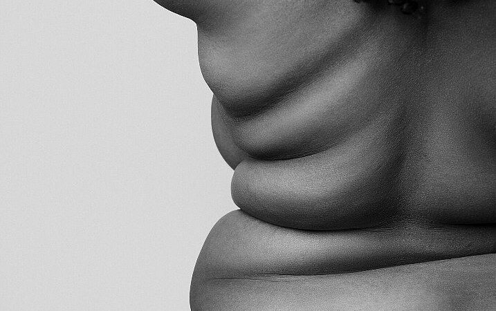 Combate à gordofobia: nutricionista fala sobre impactos e desafios da discriminação