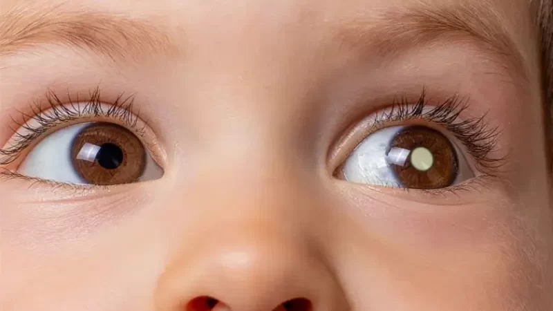 Campanha “De Olho nos Olhinhos” acontece neste sábado