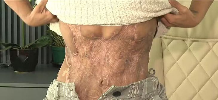 Médico é indiciado por lesões em paciente em procedimentos estéticos