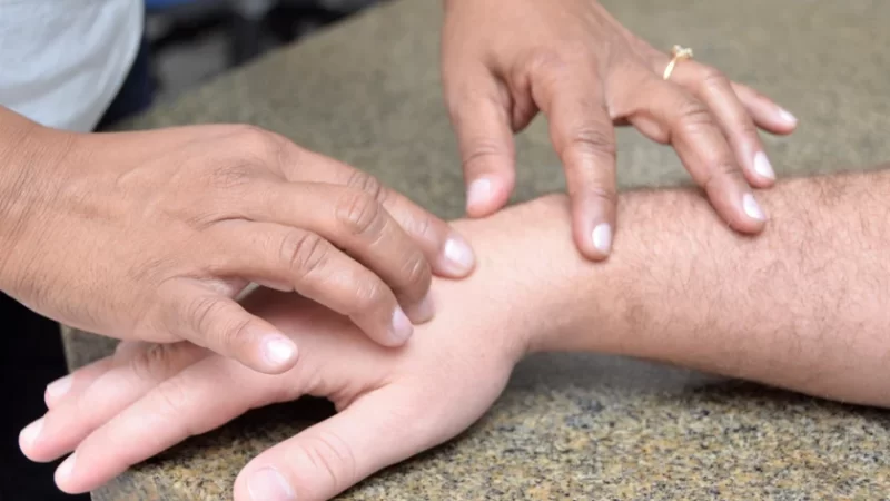 Com 192 casos registrados em AL este ano, Sesau capacitará médicos sobre hanseníase