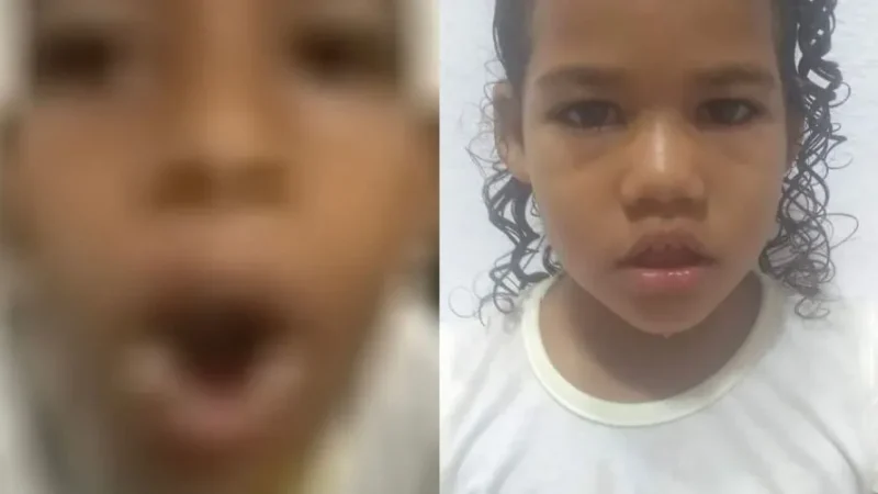 Menino que teve a boca queimada com ovo quente pela avó é irmão de criança desaparecida