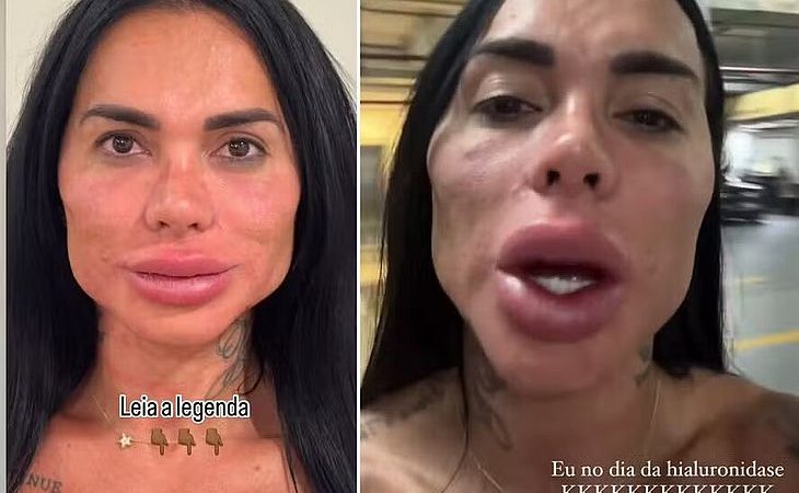 Kamila Simioni ‘choca’ a web com nova harmonização facial: ‘Toda inchada’