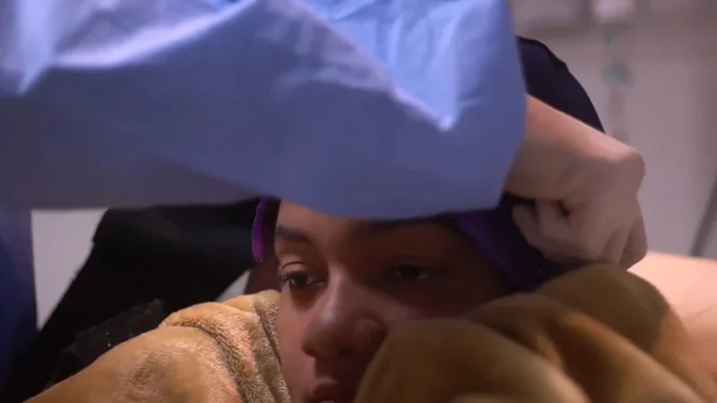 Crioteria capilar combate a queda de cabelo durante tratamento quimioterápico