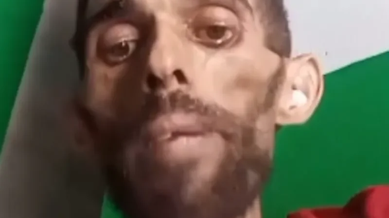 Após apelo, alagoano consegue transferência para receber tratamento para câncer