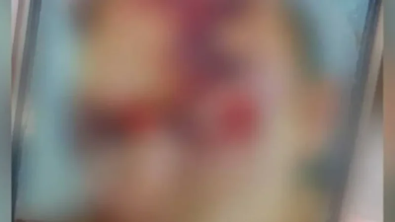 Jovem é espancado em confraternização e fica com rosto desfigurado