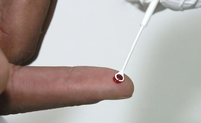 Com alta nos registros, Alagoas vai promover workshop sobre HIV e AIDS