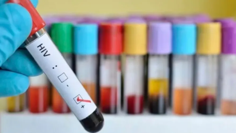 Mudanças climáticas são associadas à pior prevenção do HIV, diz estudo