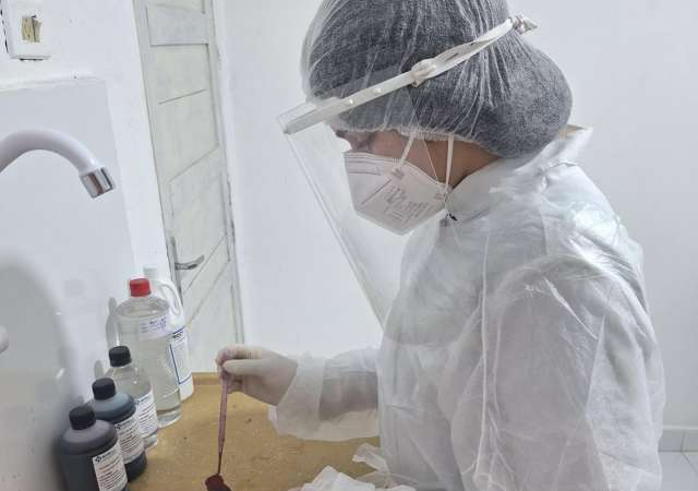 Palmeira se torna referência no diagnóstico rápido de Tuberculose e Hanseníase