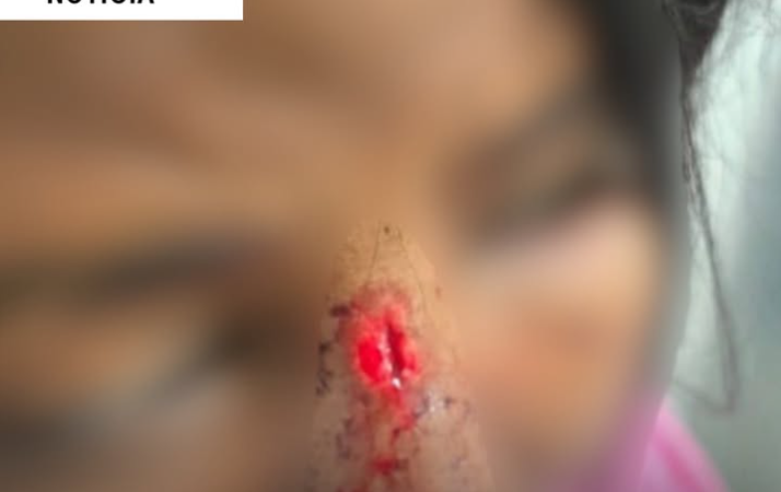 Polícia prende homem que espancou mulher com chutes na cabeçae rosto em Campo Alegre