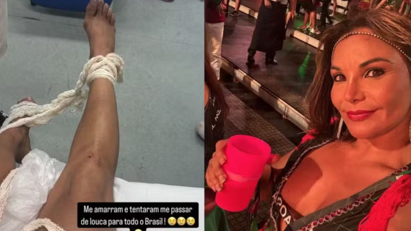 Advogada acusada de morder pessoas relata noite na Sapucaí e dá sua versão: ‘Legítima defesa’