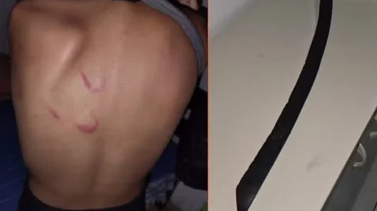 ADOLESCENTE DE 13 ANOS É RESGATADA APÓS SER AGREDIDA PELA MÃE QUE NÃO ACEITAVA A ORIENTAÇÃO SEXUAL DA FILHA, NO INTERIOR DE AL