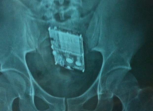 Detento morre após passar por cirurgia para retirada de aparelho celular do intestino