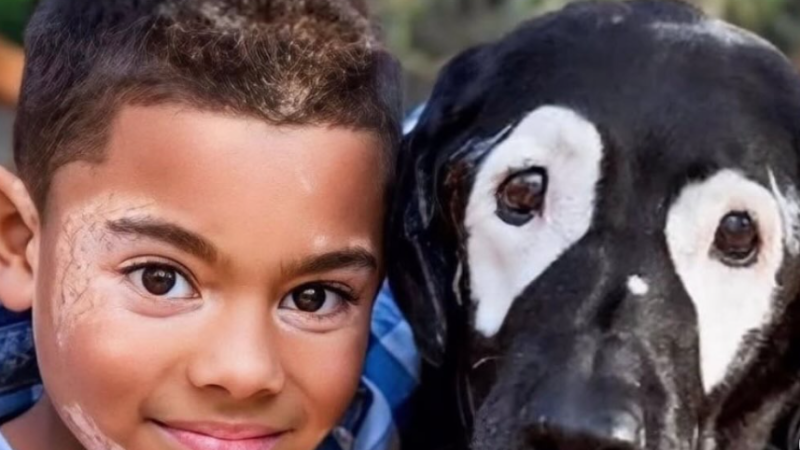 Uma amizade que cura: menino com vitiligo encontra inspiração em cão com a mesma condição