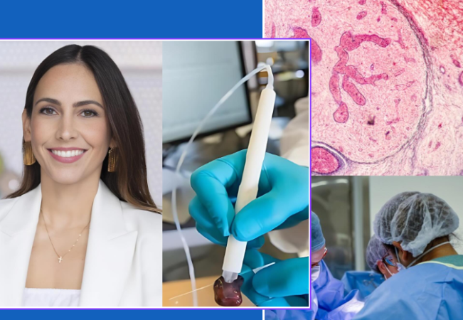 Pesquisadora brasileira cria caneta que detecta câncer em 10 segundos