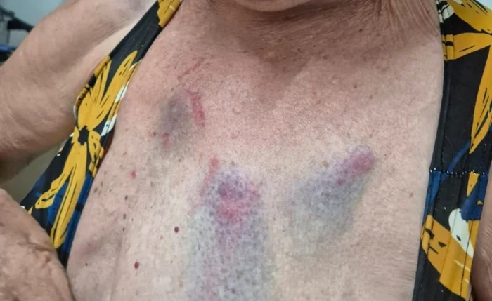 Médica é presa novamente em Arapiraca por agredir tia idosa que se recusou a fornecer senha do Wi-Fi