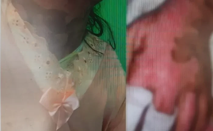 Áudios com ameaças de morte são incluídos na investigação do caso da adolescente que teve o corpo incendiado em Maravilha