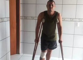 Após 1 ano de espera, paciente tem joelho errado operado