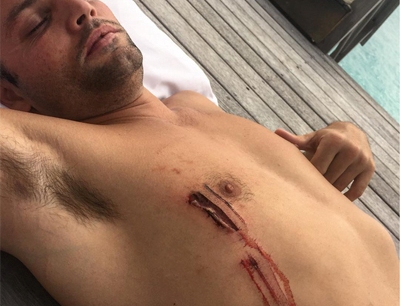 Justin Bieber e amigo sofrem ataque de tubarão na Austrália