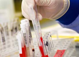 Exame de sangue pode prever risco de infarto