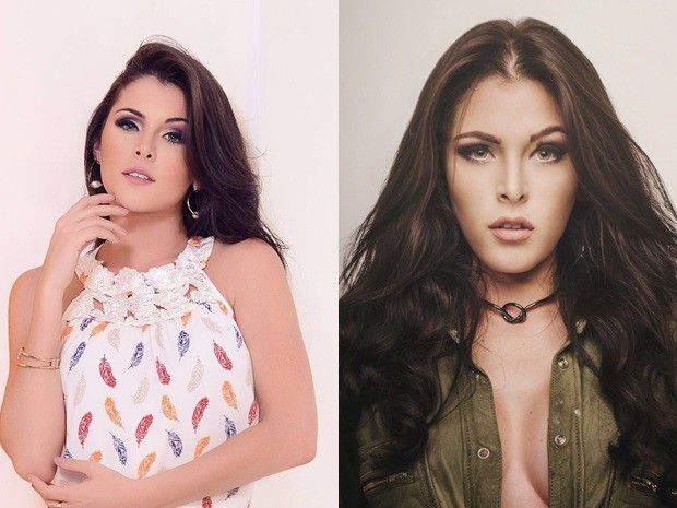 Bichectomia vira moda e ganha adeptos em Goiânia