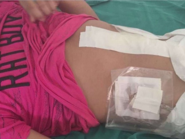 Jovem é estuprado com barra de ferro por policiais no Acre