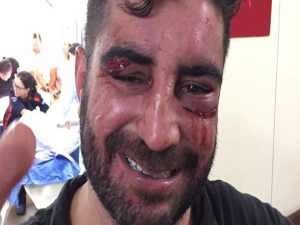 Jovem agredido por filho de Renan foi levado ao Hospital de Base